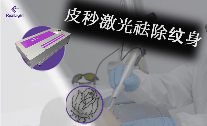 皮秒激光祛除紋身