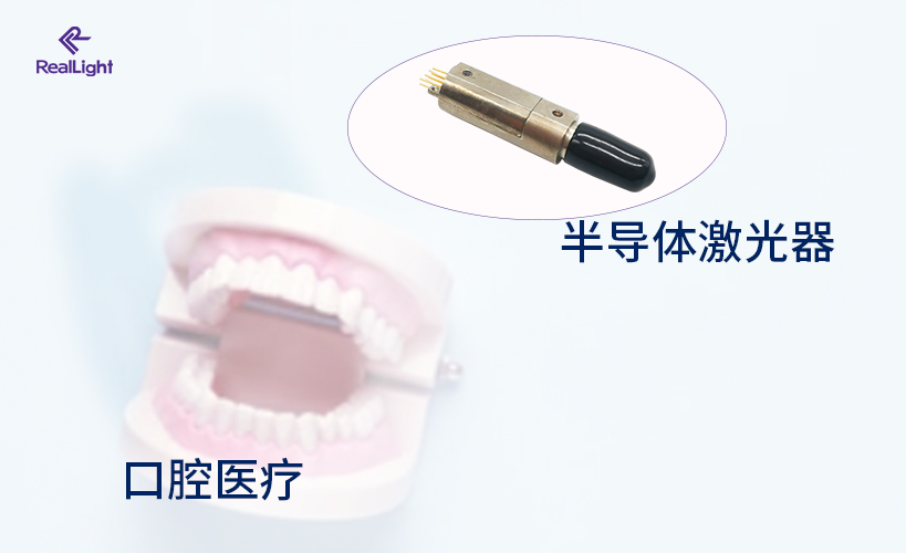 半導體激光器在口腔醫(yī)療領域的應用